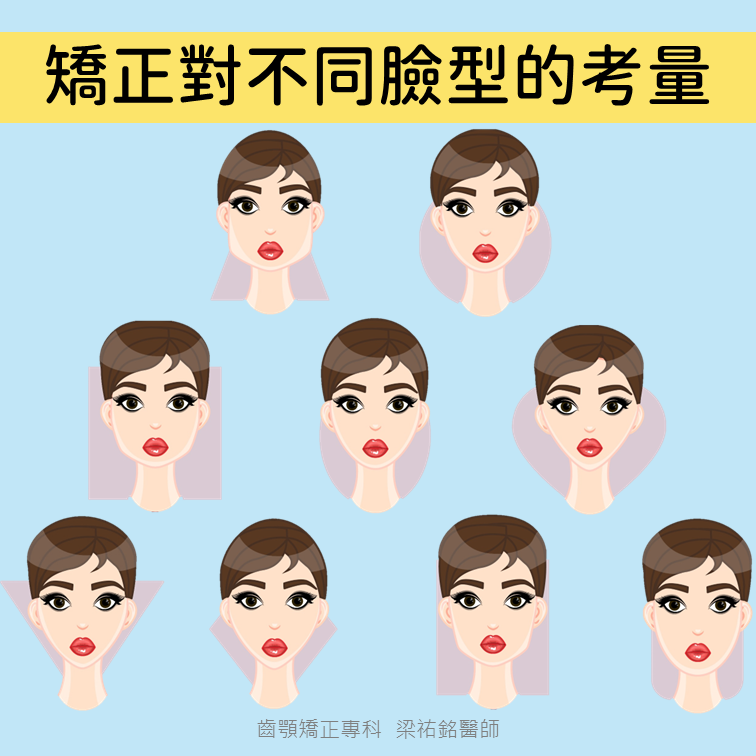 矯正對不同臉形的考量