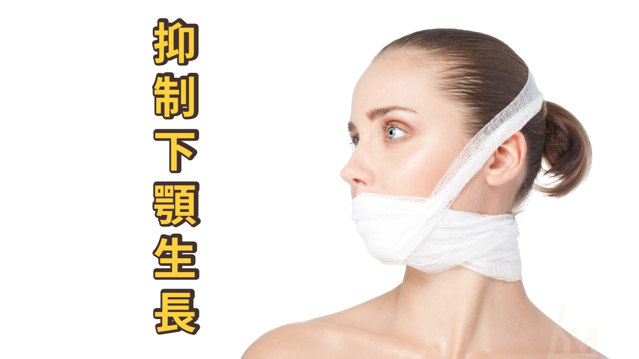【戽斗系列文章】 抑制下顎的生長