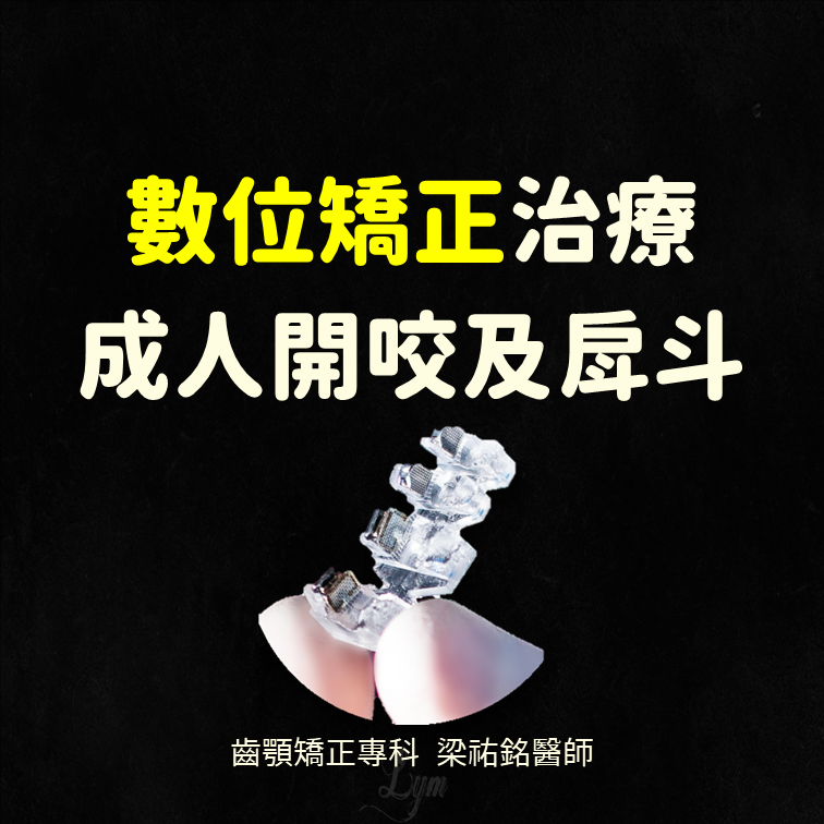 【數位矯正】治療成人開咬及戽斗