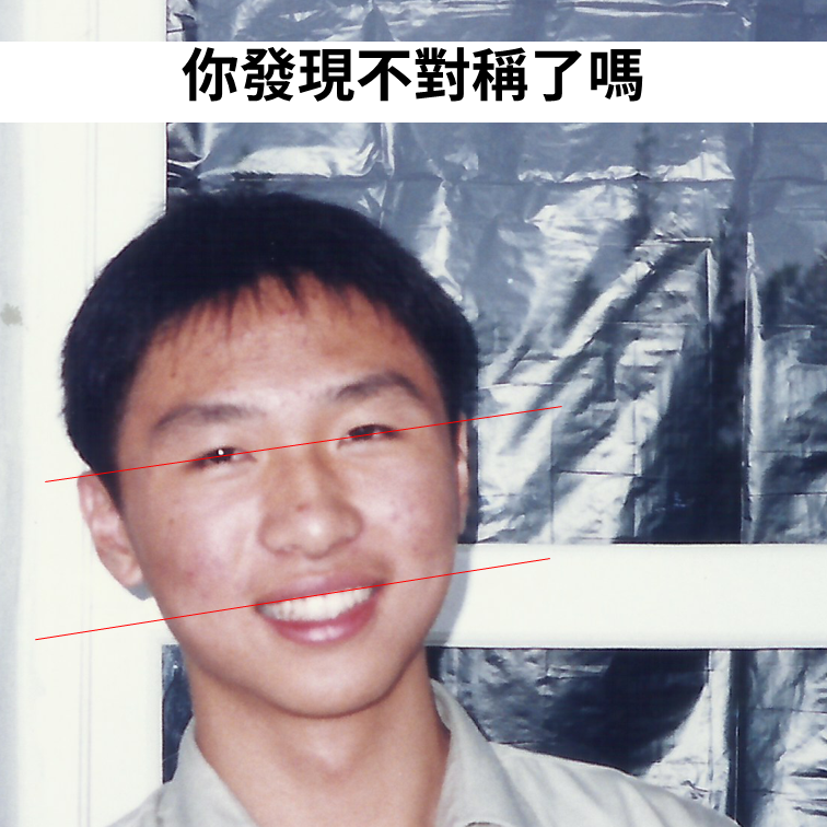 咬合平面歪斜的認知與處理方法